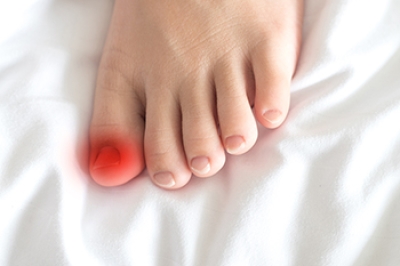 When Ingrown Toenails Need More Than Quick Fixes