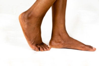 Types of Flat Feet