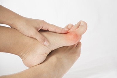 Dealing With Painful Bunions